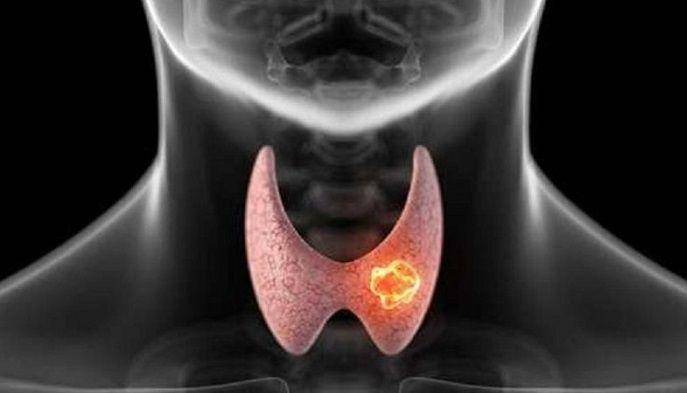 La tiroide